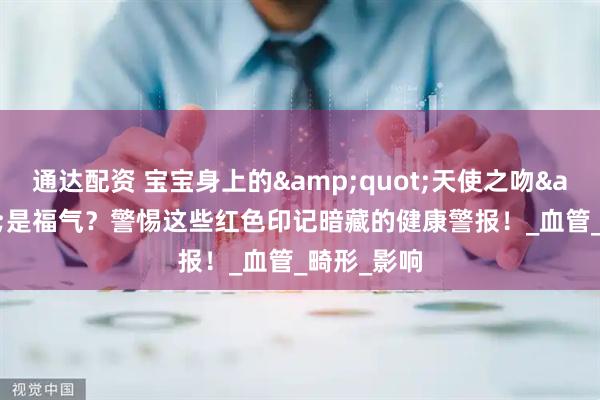 通达配资 宝宝身上的&quot;天使之吻&quot;是福气？警惕这些红色印记暗藏的健康警报！_血管_畸形_影响